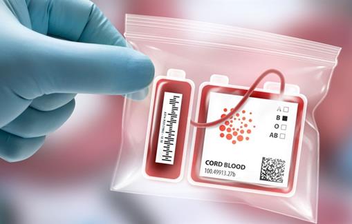 پایداری طولانی مدت واحدهای خون بندناف پس از 29 سال انجماد 