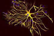 نقش حیاتی آستروسیت ها در تنظیم شبکه های عصبی 