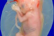 باید از جنین های سقط شده در مطالعات سلول های بنیادی استفاده کرد؟(2)