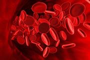 مطالعه بیماری های خونی لاعلاج کودکان با استفاده از سلول های بنیادی