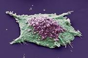 چگونه می توان سلول های خفته در تومورهای سرطانی را تخریب کرد!