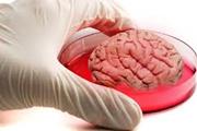 کشت سلول ها در ظروف آزمایشگاهی درهای جدیدی را برای مطالعات مغزی باز می کند