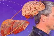 فیبروز کبد با کاهش توانایی شناختی و حجم مغز مرتبط است