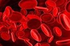 سلول های بنیادی خون بند ناف و بهبود کنترل متابولیکی دربیماران مبتلا به دیابت نوع I