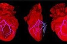 محققان معمای پروتئین های مرتبط با نارسایی قلبی را کشف کردند