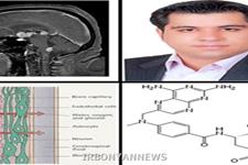 موفقیت محقق ایرانی در تهیه فرمولاسیون جدید درمان سرطان مغز