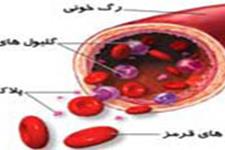 دستاورد دانشمندان ایرانی در ترمیم سلول‌های رگهای خونی برای پیوند بهتر اعضا