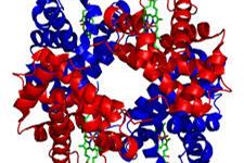 نگاهی به تغییر ساختار پروتئین ها در بیماری پارکینسون 