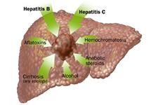 شناسایی سلول های پیش ساز سرطان کبد پیش از تشکیل تومور 