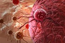 کشف ارتباط کلیدی بین آغاز و متاستاز سرطان کولون