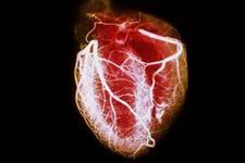 سلول های پیش ساز قلبی ابزاری قدرتمند و بالقوه برای درمان قلب های آسیب دیده در موش
