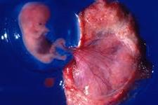 کشف مخازن(تانک ها) اکسیژن جفت برای جنین های اولیه