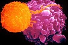 سیگنال رشد می تواند روی آسیب پذیری سلول های سرطانی تاثیرگذار باشد