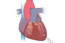 9کشف سلول های ترمیم کننده قلب در شریان های کرونری