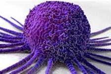 مهار متاستاز سرطان پروستات با داروی ضد HIV