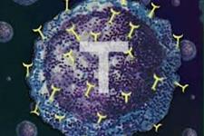 استفاده از سلول های T مهندسیNY-ESO-1 TCR شده در مطالعات بالینی بیماران مبتلا به مولتیپل میلوما
