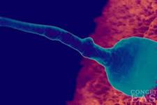 پیوند سلول های بنیادی برخی مردان عقیم به موش ایجاد سلول های زایا(germ cells) می کند 