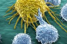 ایمنی درمانی روشی برای مبارزه با سرطان