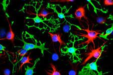 رشد شبکه های نورونی در اسفروئیدهای سه بعدی انسان