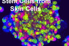 خودنوزایی و تمایز سلول های بنیادی پوست چگونه تنظیم می شود