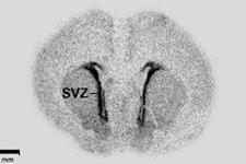 تحریک سلول های بنیادی بوسیله جمعیت نورونی ناشناخته در SVZ برای تولید نورون های جدید
