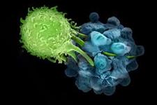 درمان بیماران مبتلا به سرطان با عفونت کشنده ی مغزی به کمک سلول های T 