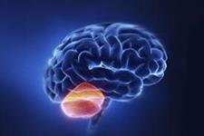 سیستم مدل مبتنی برسلول iPS به ایجاد درمان برای آتاکسی نخاعی مغزی کمک می کند