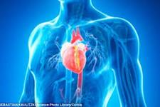 آهن می تواند بستری شدن افراد مبتلا به نارسایی قلبی را کاهش دهد و علایم آن ها را تسکین دهد