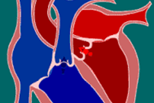 سلول های بنیادی پرتوان القایی و سلول های عضلانی قلب به کمک قلب می آیند