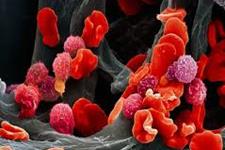 ژن BRCA1 برای تشکیل سلول های بنیادی خون ساز ضروری است