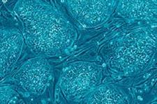بکارگیری سلول های بنیادی پرتوان القایی انسانی در پزشکی دقیق برای بیماری های وراثتی