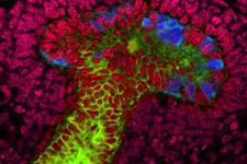 ایجاد ساختارهای کلیوی پیچیده از سلول های بنیادی انسانی بالغ