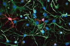 نورون های رشد یافته در آزمایشگاه، تنفس موش ها را بعد از آسیب طناب نخاعی بهبود می بخشند