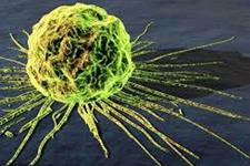 شکل تومور ممکن است روی قابلیت متاستازی سلول ها بگذارد