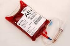 دیدگاه های جدیدی در مورد خون سازی که می تواند به درمان کم خونی کمک کند