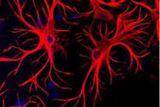 تولید آستروسیت های مغزی از سلول های بنیادی پرتوان القایی