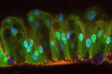 اینترلوکین22 بازسازی اپی تلیال به واسطه سلول های بنیادی روده ای را افزایش می دهد