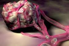 یک روش جدید مبتنی بر سلول های بنیادی برای درمان متاستاز سرطانی