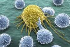 درمان های موجود برای سرطان خون، سلول های ایمنی را به اندازه 30سال پیرتر می کند