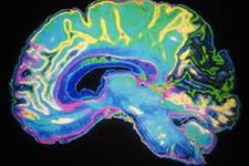 تکوین مغز تحت تاثیر سیستم ایمنی قرار دارد