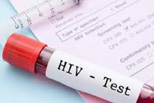 گیرنده معیوب ایمنی می تواند دلیلی برای مشکلات مربوط به HIV باشد