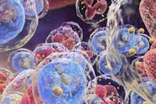 داروهای برای هدف قرار دادن پاشنه آشیل سلول های لوکمیای میلوئید مزمن