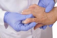 استفاده از پزشکی دقیق برای درمان آرتریت روماتوئید