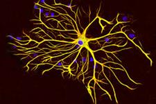 آستروسیت ها بعد از سکته، میتوکندری ها را به نورون منتقل می کنند