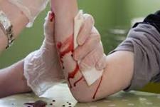 زیست ماده ای جدید برای مهار خونریزی های کنترل نشده