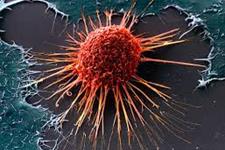 کشف یک سوئیچ جنینی برای تولید سلول های بنیادی سرطانی