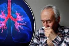 بهبود بیمار مبتلا به  بیماری ریوی COPD بعد از سلول درمانی