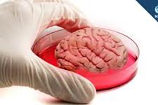 رشد بافت سه بعدی مغزمیانی درمحیط آزمایشگاه 