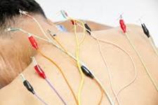 طب سوزنی الکتریکی سلول های بنیادی را برای تسکین درد آزاد می کند و ترمیم بافت را افزایش می دهد