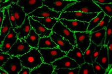 TAK1 سلول های اندوتلیالی را مقدور می سازد که از مرگ دوری کنند